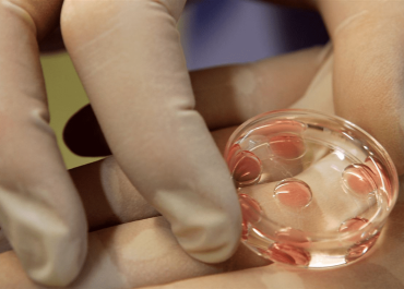 Стоит ли переносить два эмбриона при ЭКО?